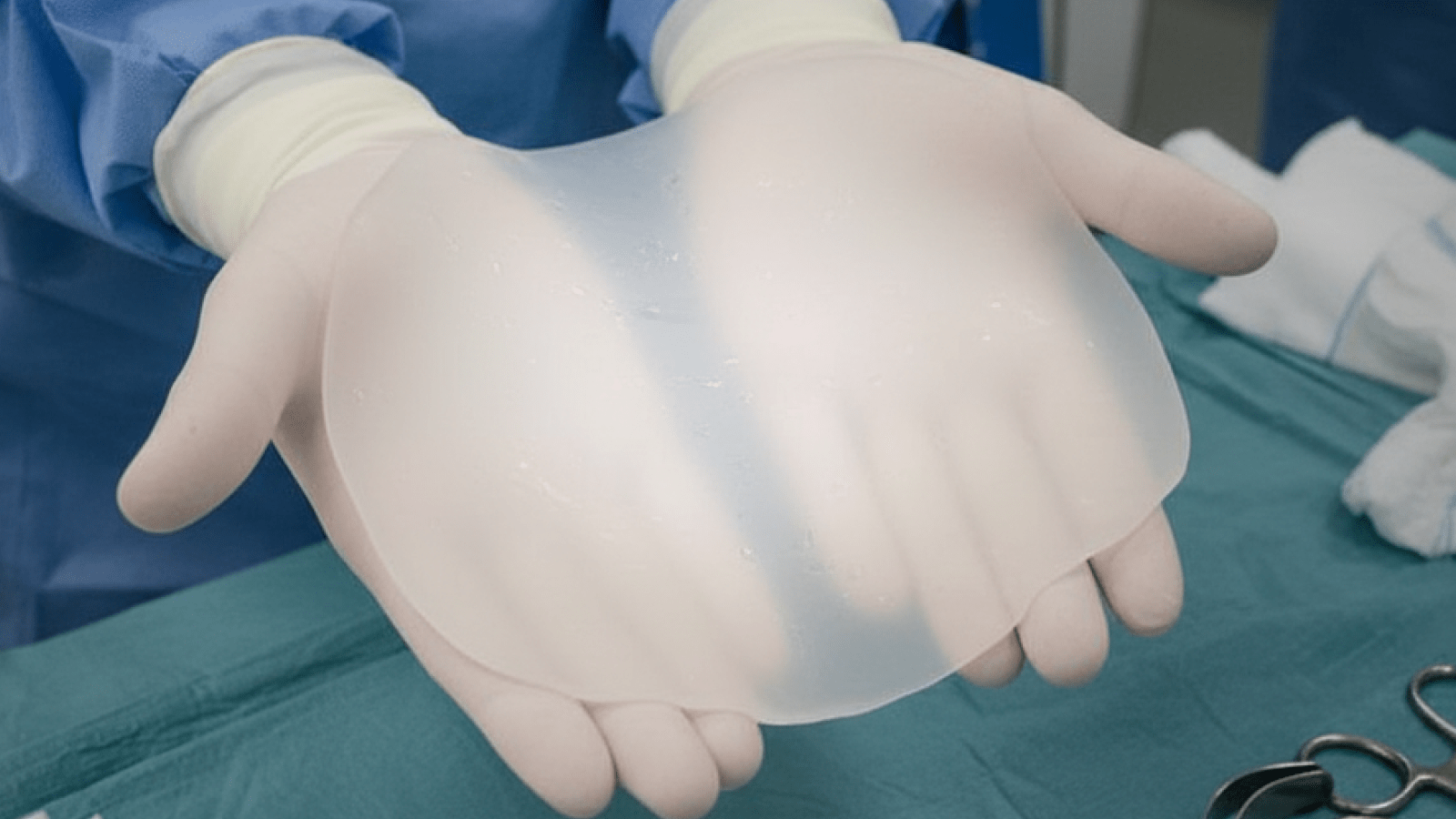implante de pectus excavatum implex