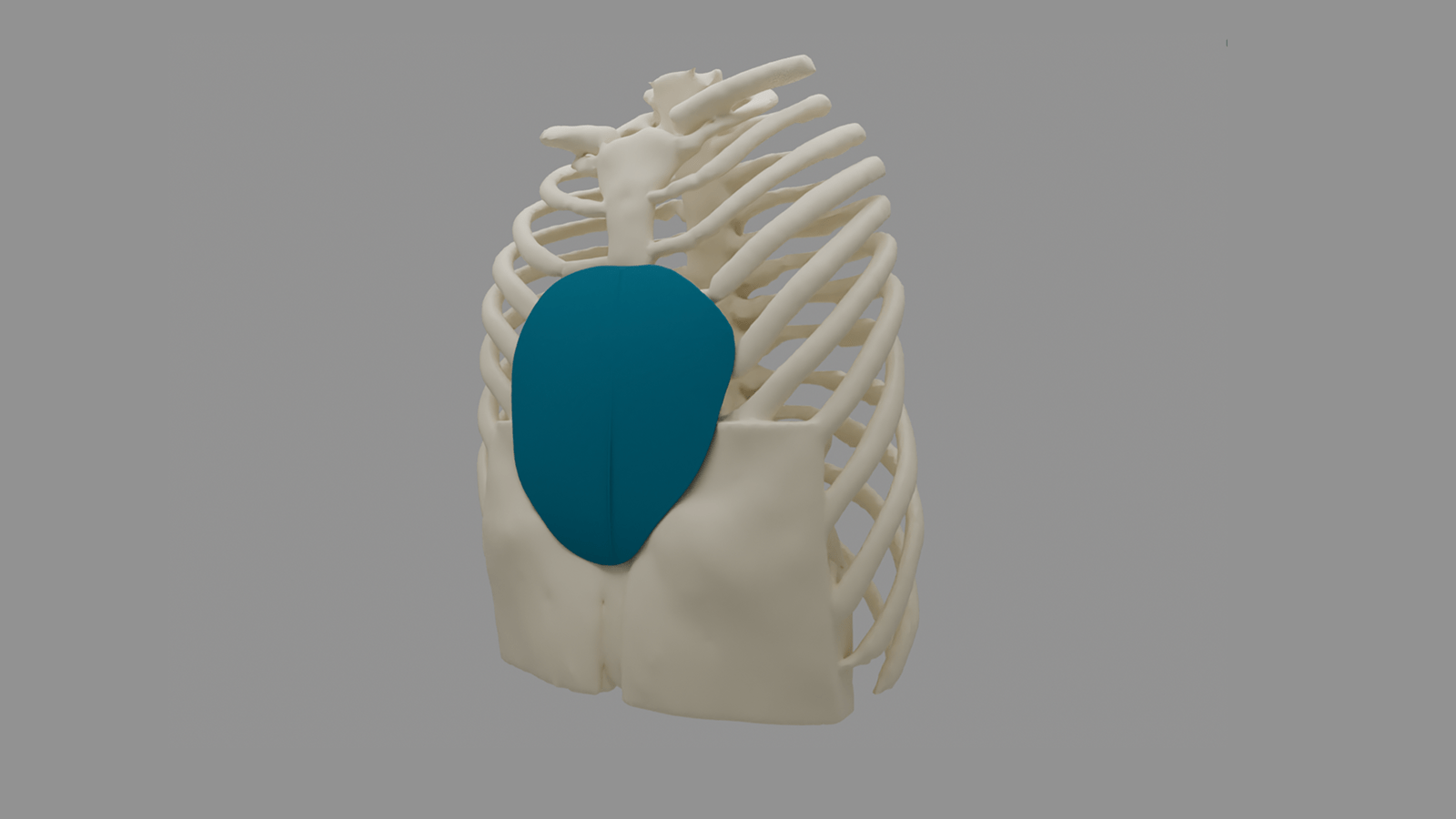 implex-diseño-3d-toracico-cirugia-implante-medida-color