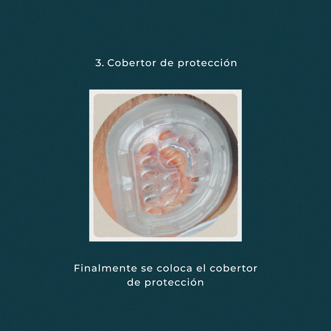 Oreja prominentes sistema earwell colocando el sistema cobertor de protección